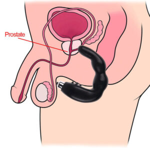 prostate massager
